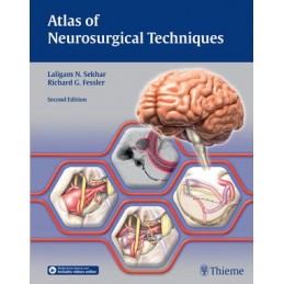 Atlas of Neurosurgical Techniques: Brain