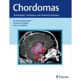 Chordomas: Technologies,...