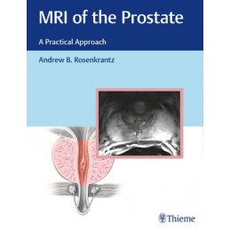 MRI of the Prostate: A Practical Approach