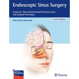 Endoscopic Sinus Surgery: Anatomy, Three-Dimensional Reconstruction, and Surgical Technique