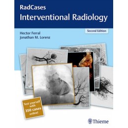 RadCases Q&A Interventional...