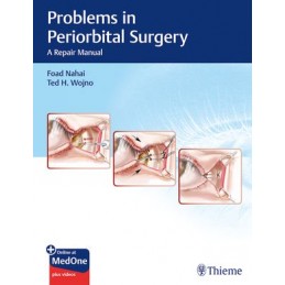 Problems in Periorbital Surgery: A Repair Manual