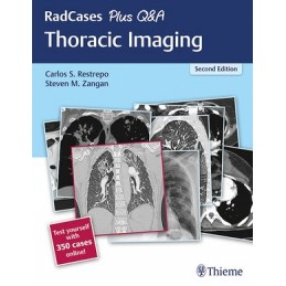 RadCases Plus Q&A Thoracic...