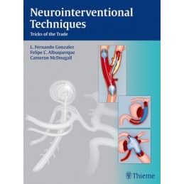 Neurointerventional...