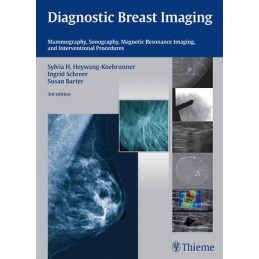 Diagnostic Breast Imaging: Mammography, Sonography, MRI and Interventional Procedures