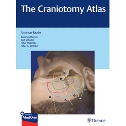 The Craniotomy Atlas