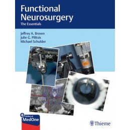 Functional Neurosurgery: The Essentials