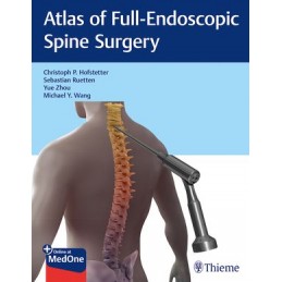 Atlas of Full-Endoscopic...