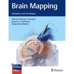 Brain Mapping: Indications and Techniques