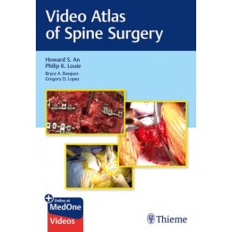 Video Atlas of Spine Surgery