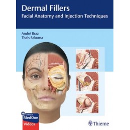 Dermal Fillers: Facial...