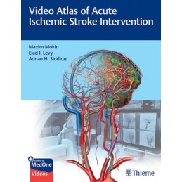 Video Atlas of Acute...