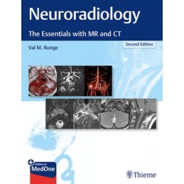 Neuroradiology: The...