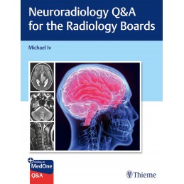 Neuroradiology Q&A for the...