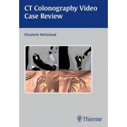 CT Colonography Video Case...