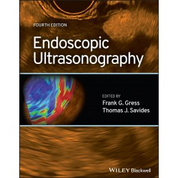 Endoscopic Ultrasonography