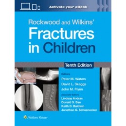 Rockwood and Wilkins' Fractures in Children: Print + digital version with Multimedia