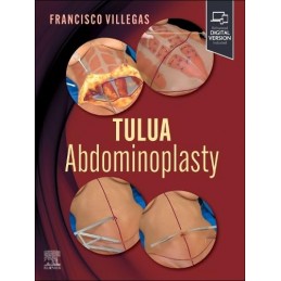 TULUA Abdominoplasty