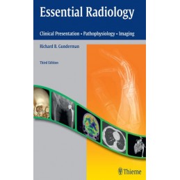 Essential Radiology:...