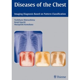 Diseases of the Chest:...