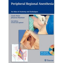 Peripheral Regional Anesthesia: An Atlas of Anatomy and Techniques