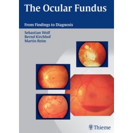 The Ocular Fundus: From...