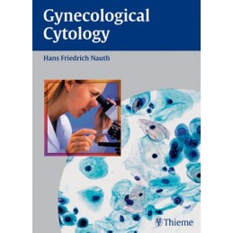 Gynecologic Cytology