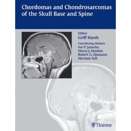 Chordomas and...