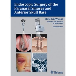 Endoscopic Surgery of the...