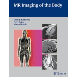 MR Imaging of the Body