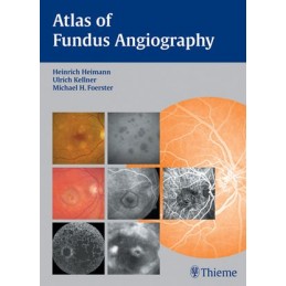 Atlas of Fundus Angiography