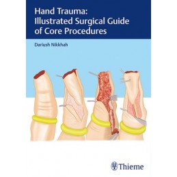 Hand Trauma: Illustrated...