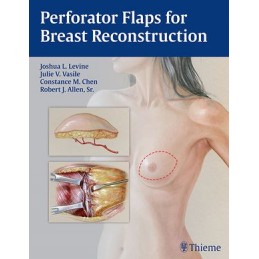 Perforator Flaps for Breast...