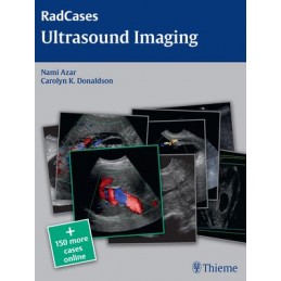 Radcases Ultrasound Imaging