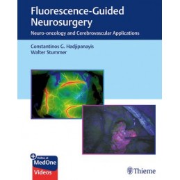 Fluorescence-Guided...