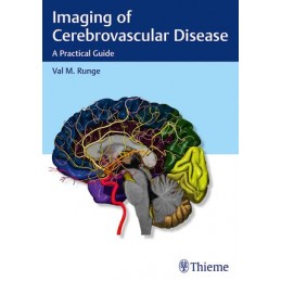 Imaging of Cerebrovascular...