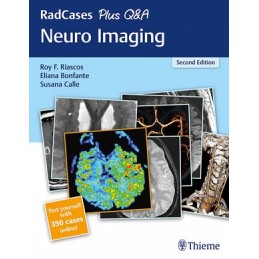 RadCases Plus Q&A Neuro...