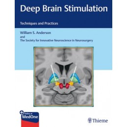 Deep Brain Stimulation:...