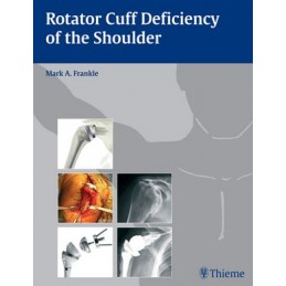 Rotator Cuff Deficiency of...