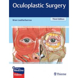 Oculoplastic Surgery