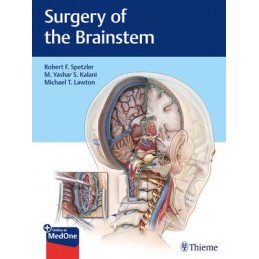 Surgery of the Brainstem