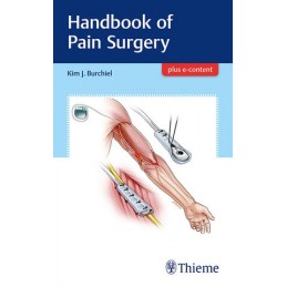 Handbook of Pain Surgery