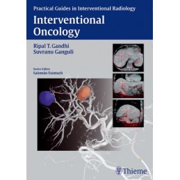 Interventional Oncology