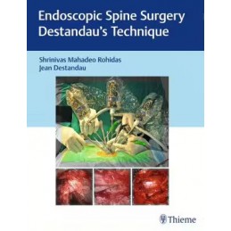 Endoscopic Spine Surgery:...