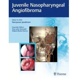 Juvenile Nasopharyngeal...