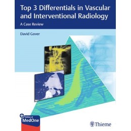 Top 3 Differentials in...