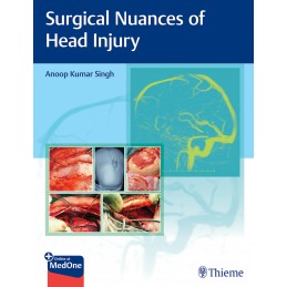 Surgical Nuances of Head Injury