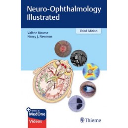 Neuro-Ophthalmology...