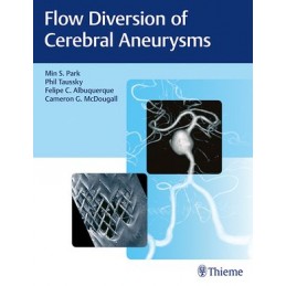 Flow Diversion of Cerebral...