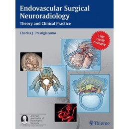 Endovascular Surgical...